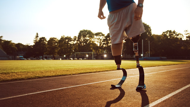 Athletic Disabled Fit Man with Prosthetic Running Blades is Posing During Preparation Befor Training on an Outdoor Stadium on a Sunny Afternoon. Amputee Runner Standing on a Track. Motivational Shot