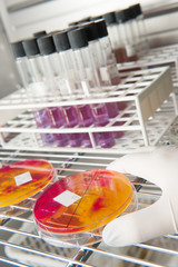 cultivation of virus bacteria in a scientific laboratory in the refrigerator