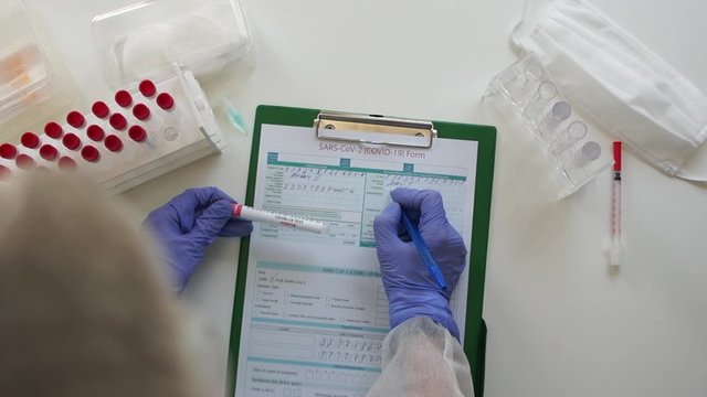 Laboratory assistant records the results of a serological blood test. PCR method for the diagnosis of coronavirus covid-19 by determination of antibodies in blood plasma