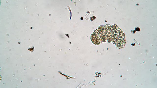 Small moss piglet is walking through algea and different bacteries in magnification. The tardigrade is sliding when it moves it's paws. Conception of microcosmos and it's inhabitants.