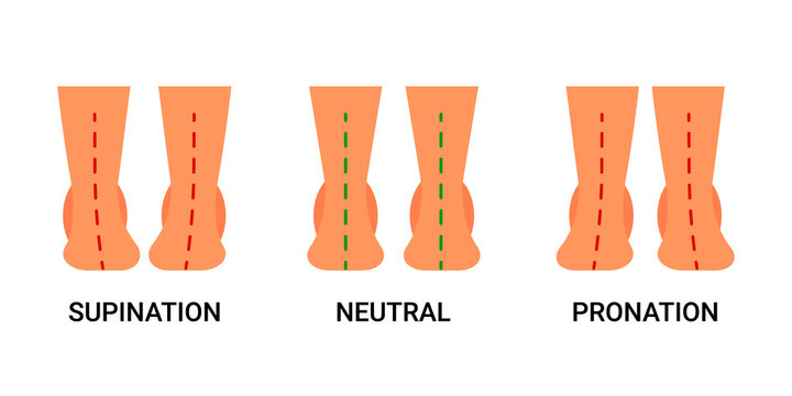 Down and dirty differences between pronation vs supination? - Foot