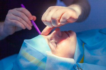 Close up of male surgeon hands making surgical marks on the patient face before blepharoplasty surgery