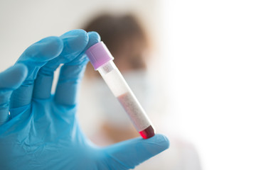 Female nurse holding test tube with blood sample with blank label