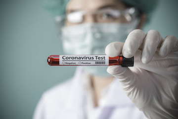 Nurse holding testing patients blood samples for Coronavirus Outbreak (COVID-19) in the laboratory, New coronavirus 2019-nCoV from Wuhan China concept