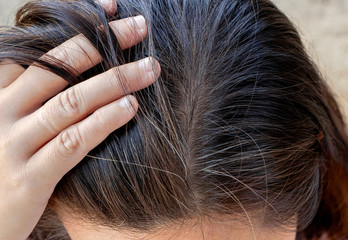 Women with damaged hair and gray hair. Close-up of the hair and scalp.