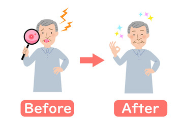 口内炎に悩むおじいちゃんのビフォーアフター