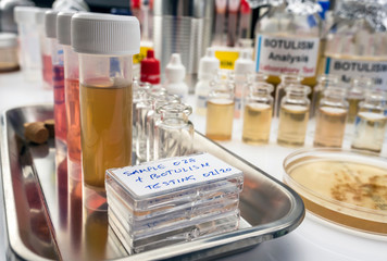 Samples contaminated by Clostridium botulinum toxin that causes botulism in humans, laboratory research, conceptual image