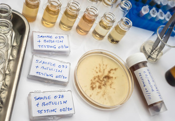 Samples contaminated by Clostridium botulinum toxin that causes botulism in humans, laboratory research, conceptual image