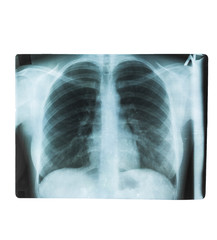 X-ray of healthy lungs. Human bones