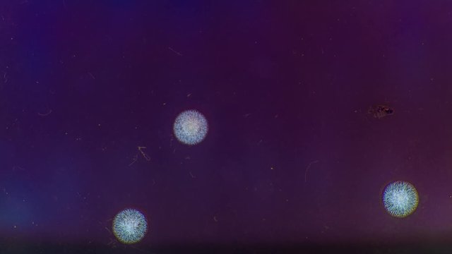 Growth of microbial colonies on a nutrient medium for 5 days. Time lapse