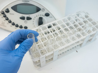 hand holding a medical sample in front of a centrifuge