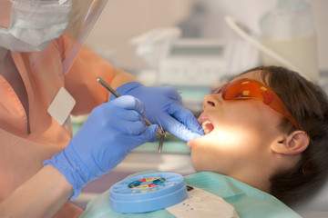 doctor cleans the canal in the tooth with an endodontic needle