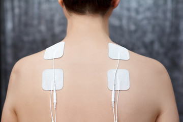 TENS therapy in fibromyalgia and cervicalgia treatment - electrodes placed on female patient's shoulders. - obrazy, fototapety, plakaty