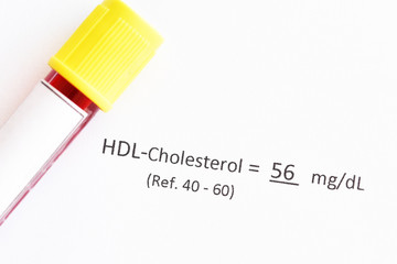 Blood sample tube with normal HDL-cholesterol test result