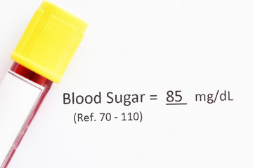 Normal blood sugar test result with blood sample tube