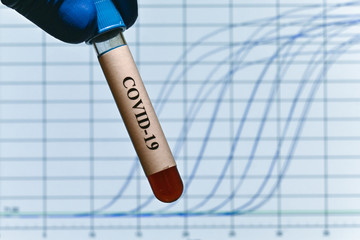 PCR diagnostics COVID-19.