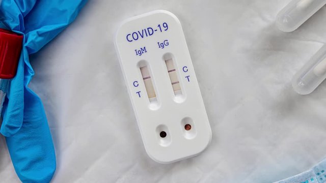 antibody immunological serological quick covid-19 test igg positive zooming