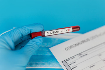 Positive blood test result for the new rapidly spreading Coronavirus