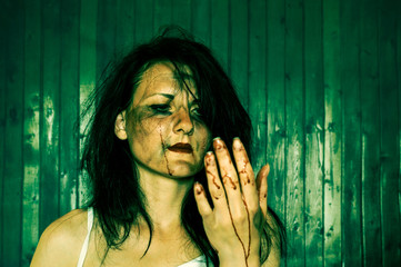 A battered woman looks at her injured hand.