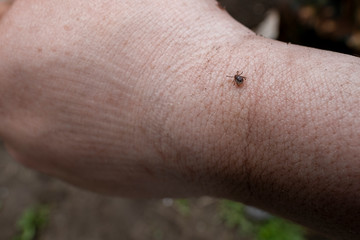 Fototapeta premium Tick on a man’s hand