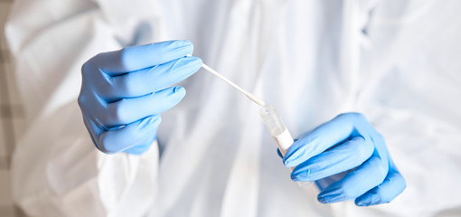 Doctor holding swab test tube for 2019-nCoV analyzing. Coronavirus test. Blue medical gloves and...