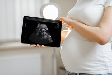 Pregnant woman holding digital tablet with an ultrasound scan of her unborn baby, standing in...
