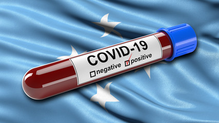 Fototapeta premium Flag of Micronesia waving in the wind with a positive Covid-19 blood test tube. 3D illustration concept for blood testing for diagnosis of the new Corona virus.