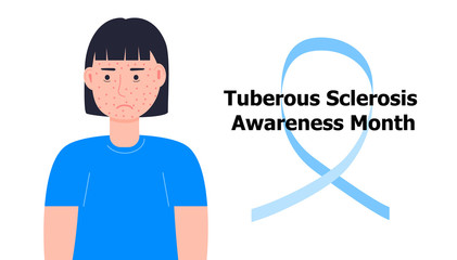 Tuberous sclerosis awareness month is celebrated in USA. Patient with rash, pimples are shown. Blue ribbon vector. Health care illustration for banner, web
