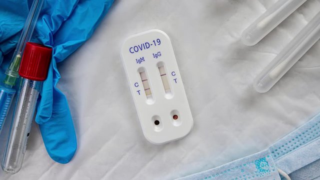 antibody immunological serological quick covid-19 test igm positive