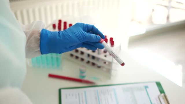 Close-up of the hand of a laboratory assistant registering samples. Laboratory studies of coronavirus infection. Search for vaccine against covid-19