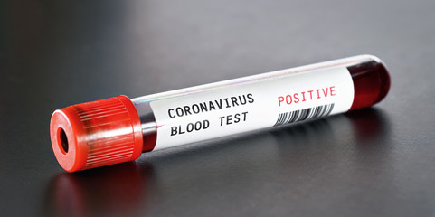 Sample vial with blood on black desk, label says coronavirus test, positive result.  (sticker is own design, dummy barcode) Covid-19 outbreak concept