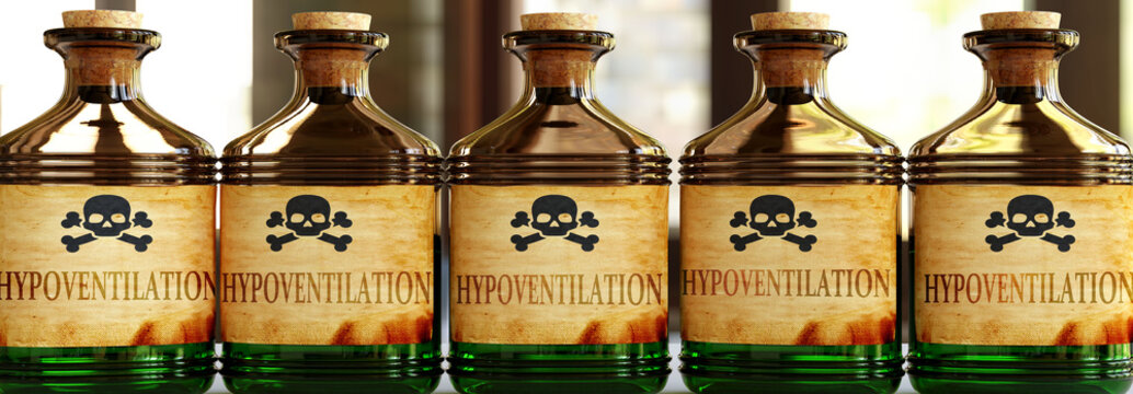 Hypoventilation can be like a deadly poison - pictured as word Hypoventilation on toxic bottles to symbolize that Hypoventilation can be unhealthy for body and mind, 3d illustration