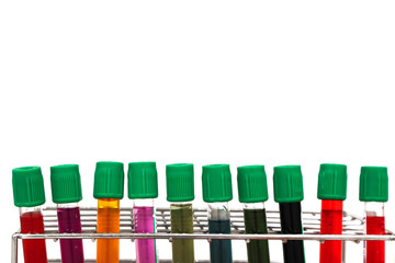 Cell culture tube on rack with green cap, isolated in white background, with colorful solvent solution for testing vaccine, anti-virus, anti-body and antigen analysis in blood test sample in vitro.