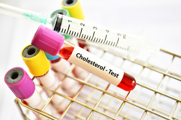 Test tube with blood sample for cholesterol test
