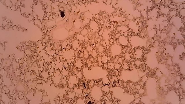 Microscope Rabbit Lung Injected Section x1200