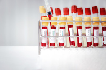 Blood samples in tubes and syringes on work table in a medical examination lab.