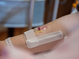 Close up of a canula inserted into a patient's arm