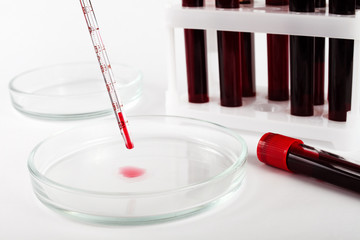 Glass pipette and petri dish on the laboratory bench