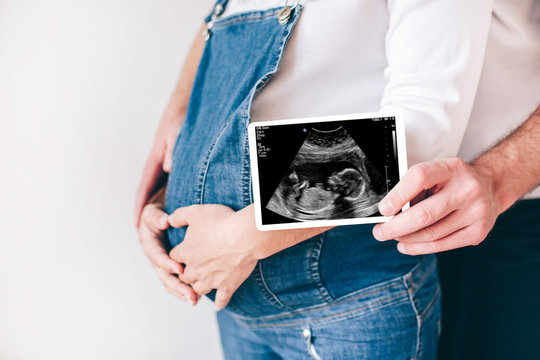 Young man and woman stand together isolated over white background. Guy hold ultrasound picture of their future bavy in hands. Woman hold hands on belly. Waiting for a newborn and infant.