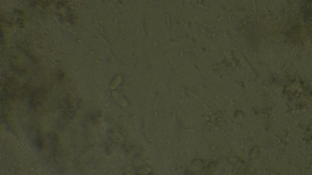 Microscopy of bifidobacterium and lactobacillus sample in a dairy product.