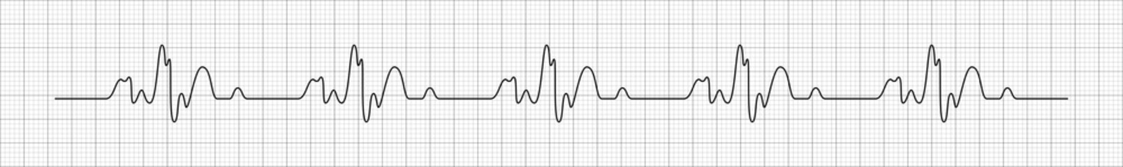 Heart rhytm. Electrocardiogram. Heartbeat. Heartbeat line. Vector illustration.