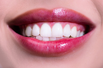 Naklejka premium Laughing woman mouth with great teeth. Perfect smile after bleaching. Dental care and whitening teeth. Healthy smile, smaling.