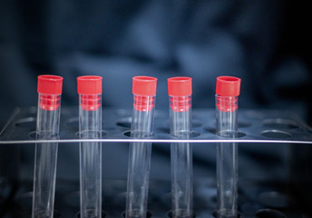 Rows of laboratory test tubes  use for experiment scientist. For the science room and laboratory room.