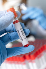 Fototapeta premium Cropped view of scientist in latex glove holding test tube with blood sample, Test tube with blood sample for COVID-19 test, novel coronavirus 2019