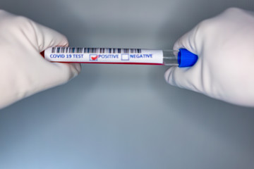 Obraz premium Blurry image of a nurse hands while holding a test tube containing a patient’s sample that has tested positive for coronavirus