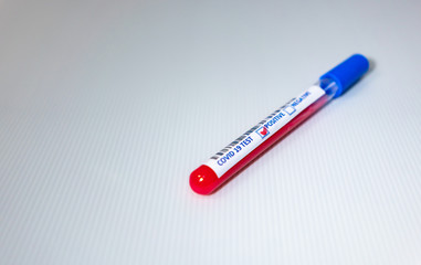 Blurry image of a Sample blood in test tube of Coronavirus (Covid-19). Coronavirus Covid 19 infected blood sample in a test tube