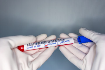 Obraz premium Blurry image of a nurse hands while holding a test tube containing a patient’s sample that has tested positive for coronavirus