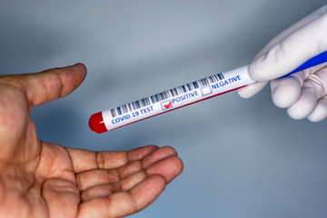 Obraz premium Blurry image of a hand while holding a test tube containing a patient’s sample that has tested positive for coronavirus and giving it to another person not wearing gloves