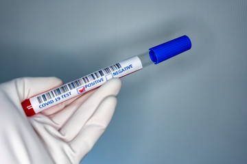 Blurry image of a nurse hands while holding a test tube containing a patient’s sample that has tested positive for coronavirus