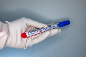 Obraz premium Blurry image of a nurse hands while holding a test tube containing a patient’s sample that has tested positive for coronavirus